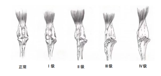 狗狗髌骨脱位