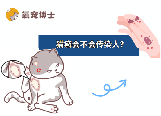 猫癣会不会传染人？